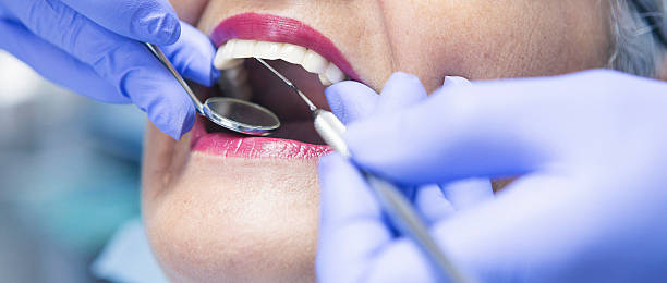 Best Root Canal Emergency Dentist  in Stallion Springs, CA